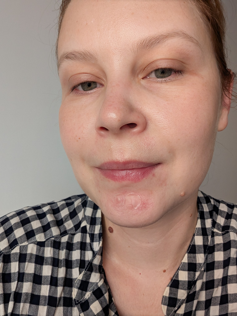 Pestle&Mortar Spot Dots naplasti na vyrazky recenzia